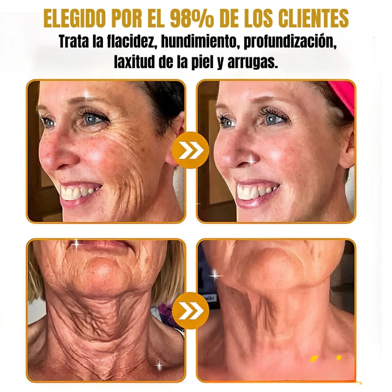 Bee Venom - Suaviza arrugas en 2 minutos - Sérum anti-envejecimiento rápido y efectivo