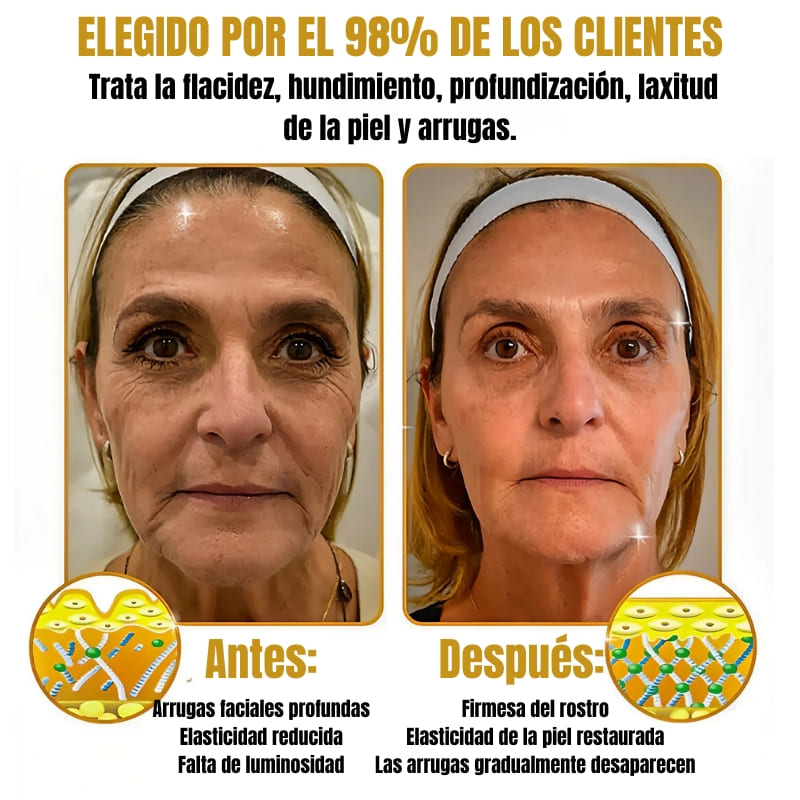 Bee Venom - Suaviza arrugas en 2 minutos - Sérum anti-envejecimiento rápido y efectivo