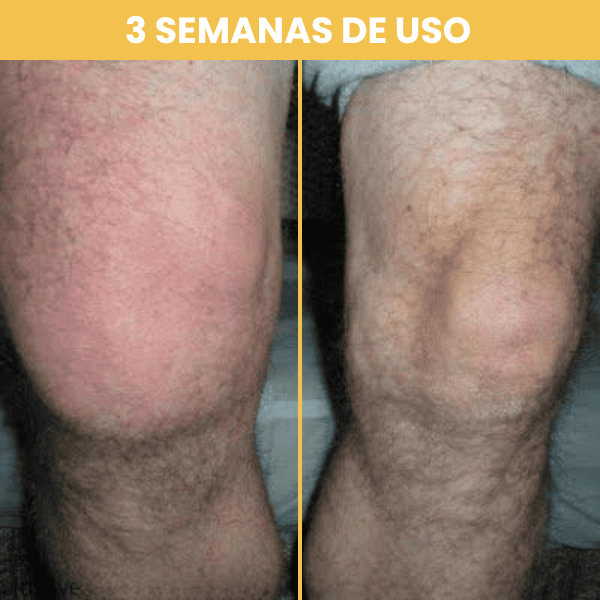 Bee Venom – Crema Calmante para Articulaciones