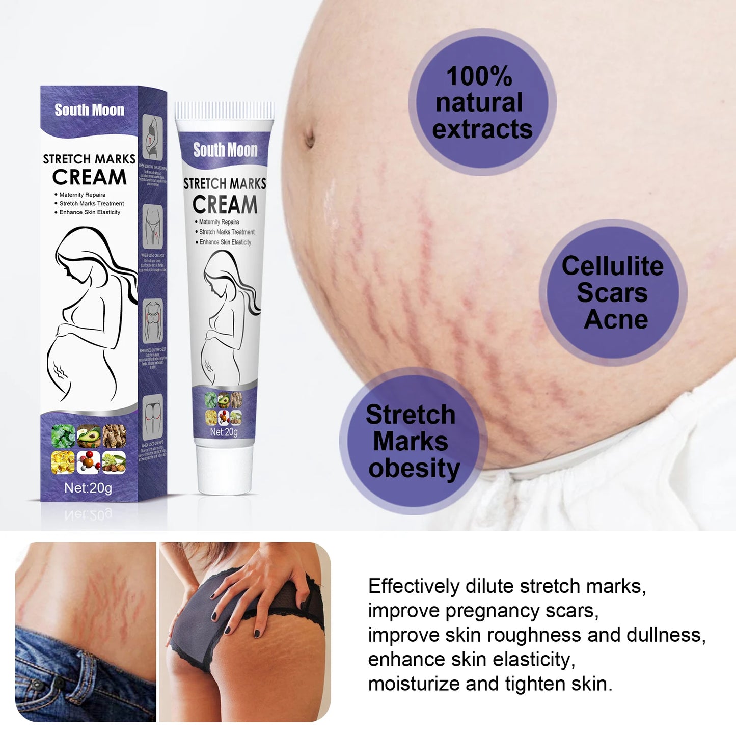 Stretch Marks Crema para eliminar las estrías del embarazo