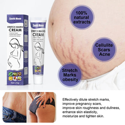Stretch Marks Crema para eliminar las estrías del embarazo