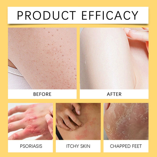 Boost de Colágeno - Bee venom